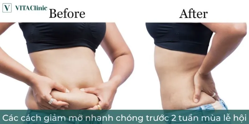Viên uống hỗ trợ giảm cân cấp tốc