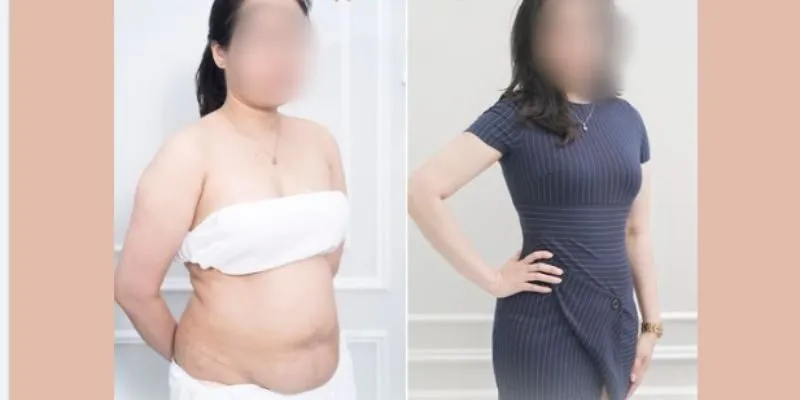 Viên uống hỗ trợ giảm cân cấp tốc